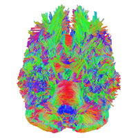 Rendering of brain activity created by SNAP Lab research