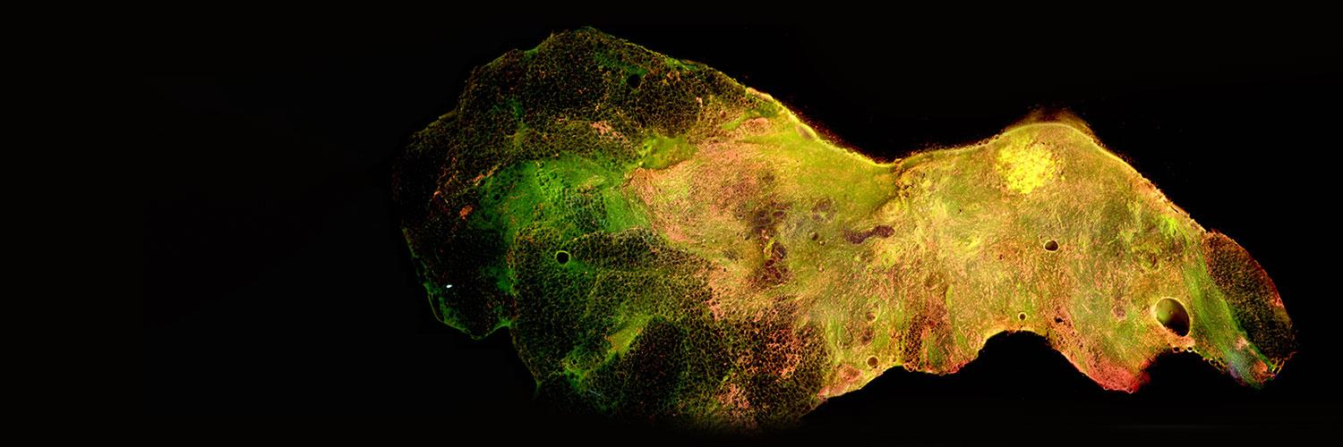 Biophotonic Tumor Margin Imaging Sample