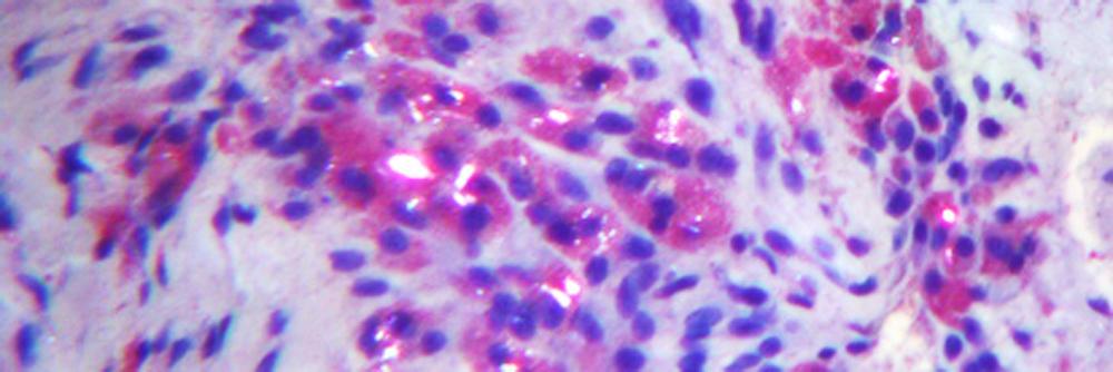 H&E stain of bone tissue