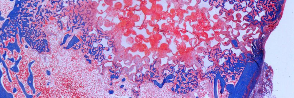 Imaging of bone graft biomaterial