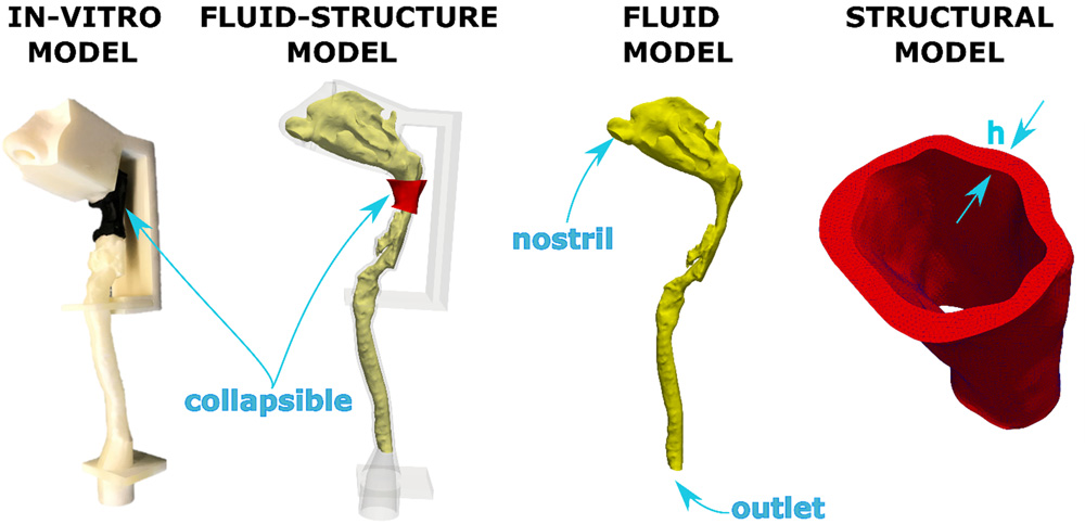 Fluid Structure Interaction Model, including illustrations of In-vitro model, fluid-structure model, fluid model and structural model