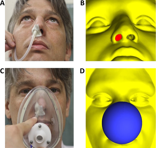 Rhinomanometry used to quantify nasal resistance to airflow in human