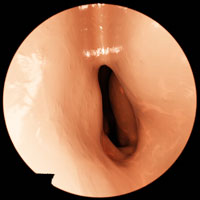 Endoscopy of esophagus