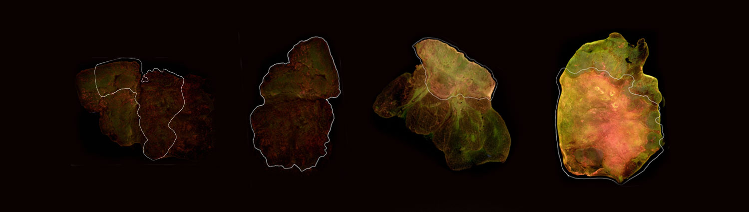 Breast tissue samples from Marquette-MCW Biophotonics Lab