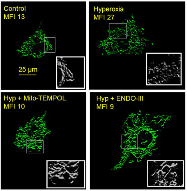 Representative high resolution images of pulmonary endothelial cells (PECs) exposed to normoxia (control) hyperoxia for 48 hours, hyperoxia+mito-TEMPOL for 48 hours, or hyperoxia+ENDO III (mt-tat-endonuclease III) for 48 hours.