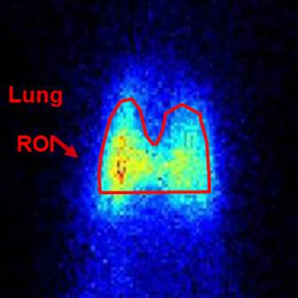 SPECT imaging of rodent lung