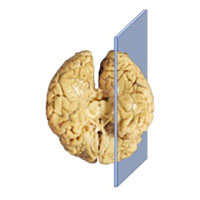 Posterior view of the brain with transparent sagittal plane transecting the left hemisphere