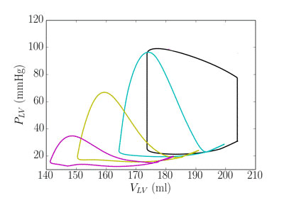 Pressure vs volume with intraventricular device at various speeds