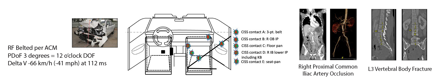 Sample case study - Occupant Kinematics