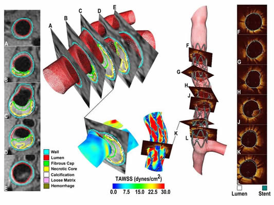 Image of Lab for Translational, Experimental and Computational Cardiovascular Research