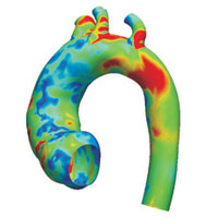 Computer-generated aorta with colors indicating relative wall shear stress