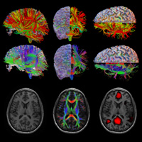 Nine renderings of human brain