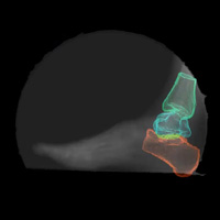 X-ray of ankle, lateral view, with colors denoting relevant structures