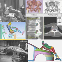 Bone grafting in porcine model