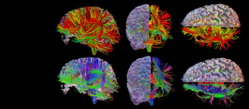 Rendering of neural networks in the brain 