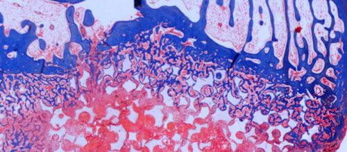 Tissue samples from Dr. Jeffrey Toth's Biomaterials & Histology Laboratory