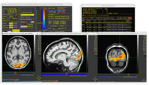 Closeup of Brain Imaging