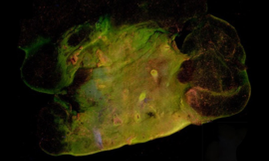 Breast tumor margin imaging sample