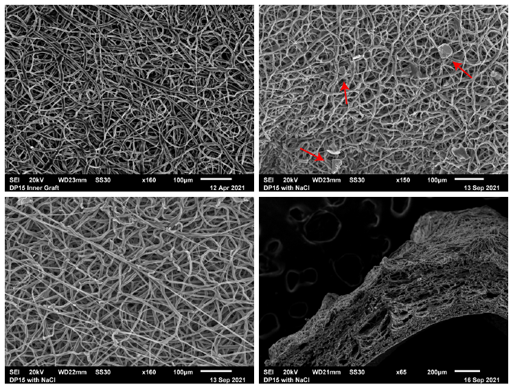 Stages of nanofiber matrix creation as seen under scanning electron microscope