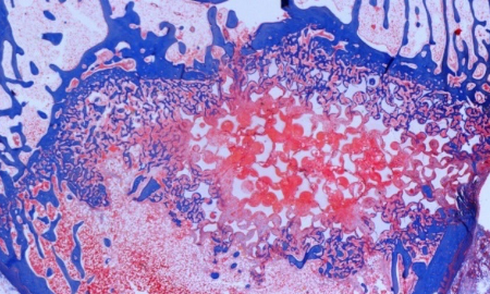 Stain of cross-section of bone graft