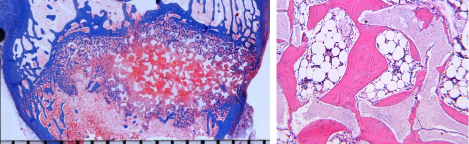 Histology images showing (left) early bone healing with calcium phosphate granules in a rabbit femoral corticocancellous bone defect model (Masson Trichrome, mm scale in field) and (right) complete incorporation of calcium phosphate granules in the same model at a later time point (H&E, original magnification = 79x).