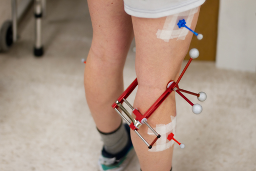 gait analysis tracking markers on knee