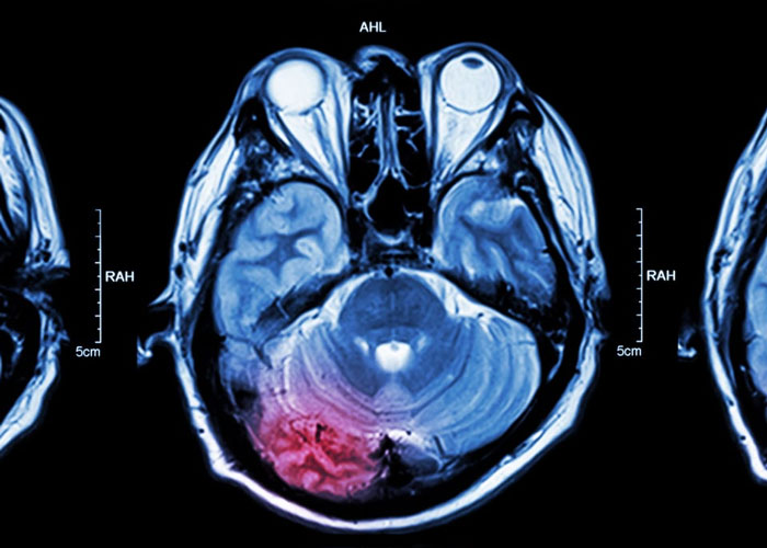 Brain Scans
